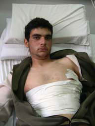 Un garcon de 16 ans gravement blessé par des tirs à balles réelles lors d'une invasion de l'armée israélienne à Azzoun